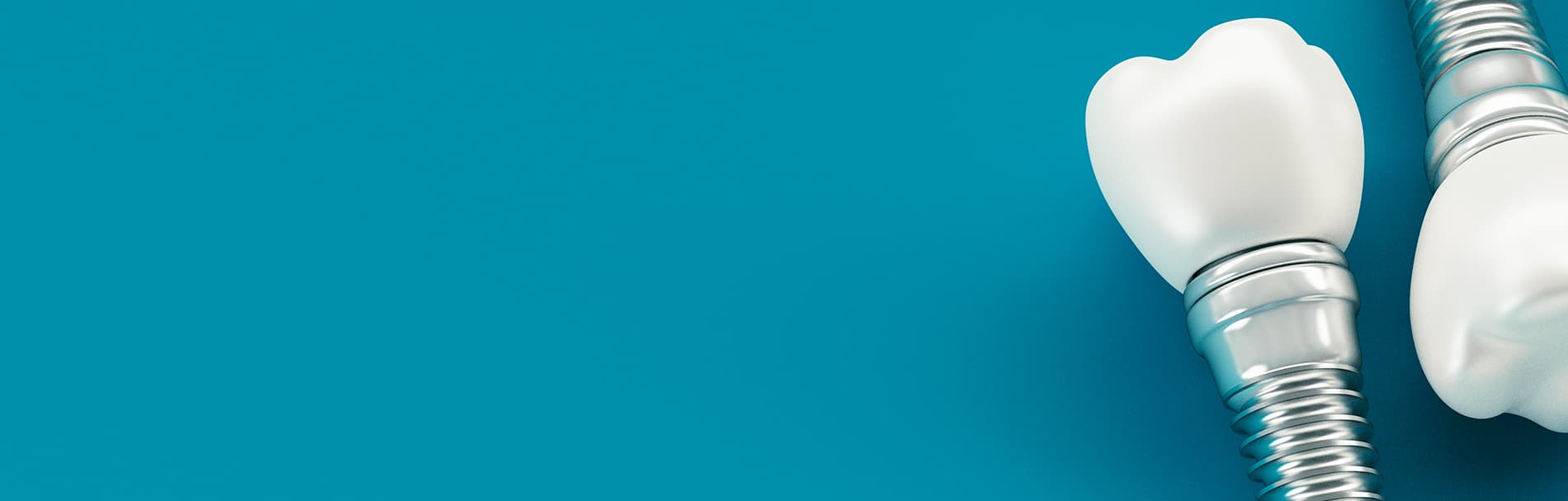 Reiningen van tandimplantaten